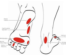 Load image into Gallery viewer, Custom Made Orthotics