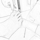 Load image into Gallery viewer, Medical Foot Care in Ottawa