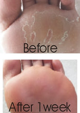 Load image into Gallery viewer, Footlogix PEELING SKIN FORMULA