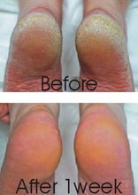 Load image into Gallery viewer, Footlogix ROUGH SKIN FORMULA