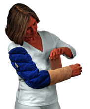 Load image into Gallery viewer, Caresia ™ Upper Extremity

